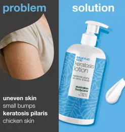 Australian Bodycare Salicylic Acid Keratosis Lotion 500 ml