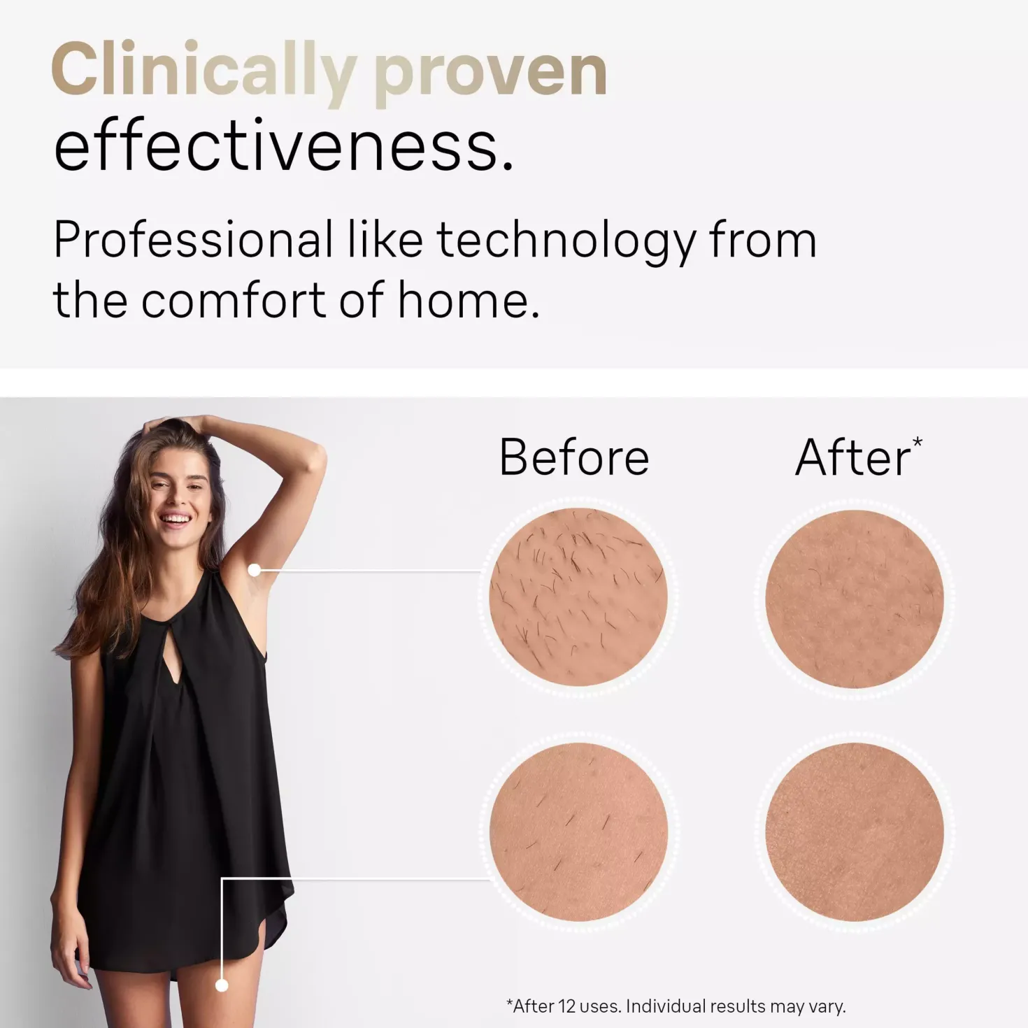 Braun IPL Silk·expert Pro 5 At Home Hair Removal With Pouch Venus Razor 2 Heads PL5152