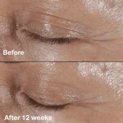 CliniqueSmart Clinical Repair Wrinkle Correcting Eye Cream 15 ml