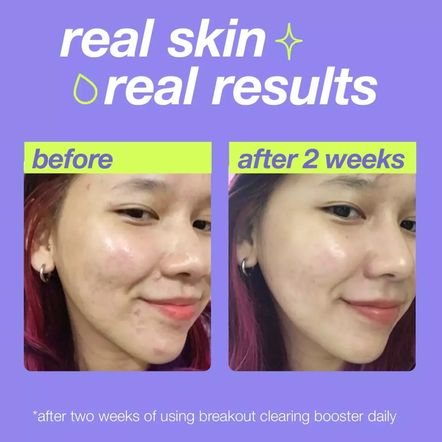 DermalogicaClear Start Breakout Clearing Booster 30 ml