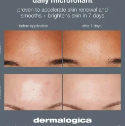 DermalogicaDaily Microfoliant 13 g
