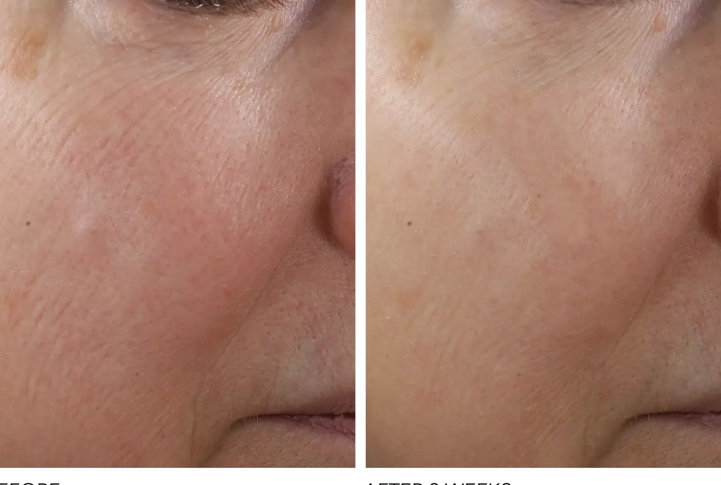 Dr Dennis Gross Advanced Retinol + Ferulic Texture Renewal Serum 30 ml
