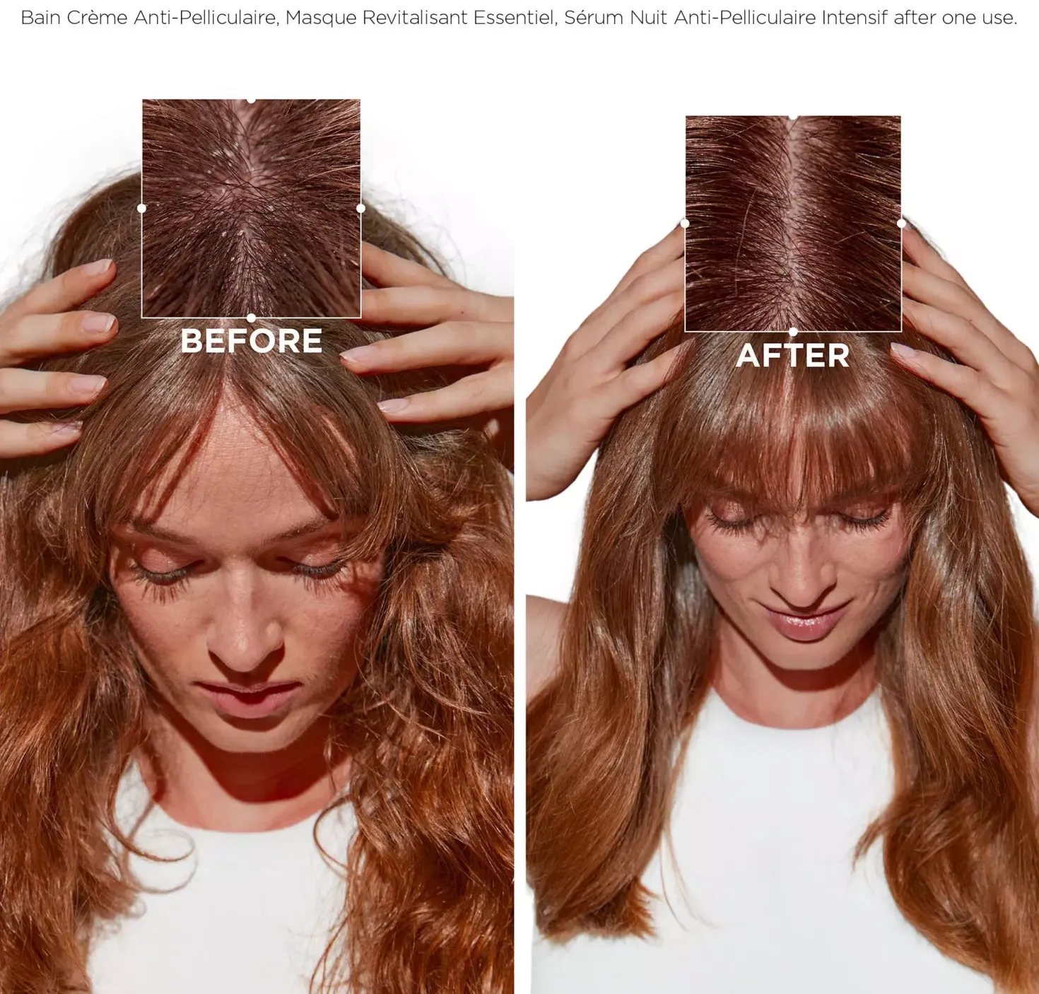 KérastaseSymbiose Micropeel Treatment 200 ml