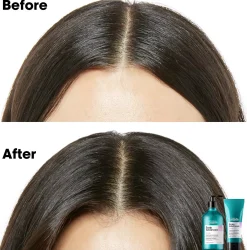 L'Oréal ProfessionnelScalp Advanced Anti-Discomfort Treatment 300 ml