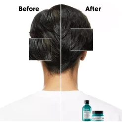 L'Oréal ProfessionnelScalp Advanced Professional Shampoo For Oily Scalp 300 ml