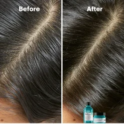 L'Oréal ProfessionnelScalp Advanced Professional Shampoo For Oily Scalp 300 ml