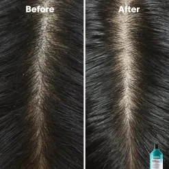 L'Oréal ProfessionnelScalp Advanced Professional Shampoo 300 ml