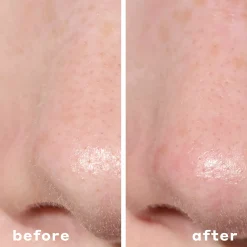 Mario Badescu 2-In-1 Deep Cleansing Pore Strip