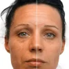 Medik8Recovery Ultimate Recovery Bio-Cellulose Mask 6-pack