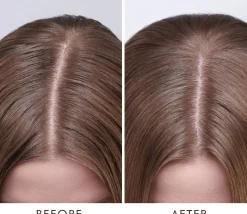 Moroccanoil Behandling för torr hårbotten - DRY 45 ml