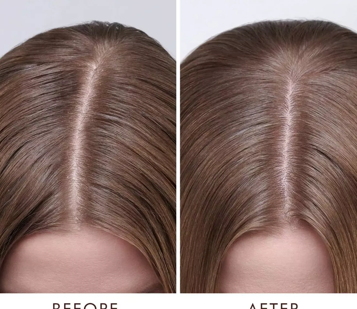 Moroccanoil Behandling för torr hårbotten - DRY 45 ml