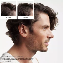 NioxinSystem 2 Loyalty Kit for Thinning Hair