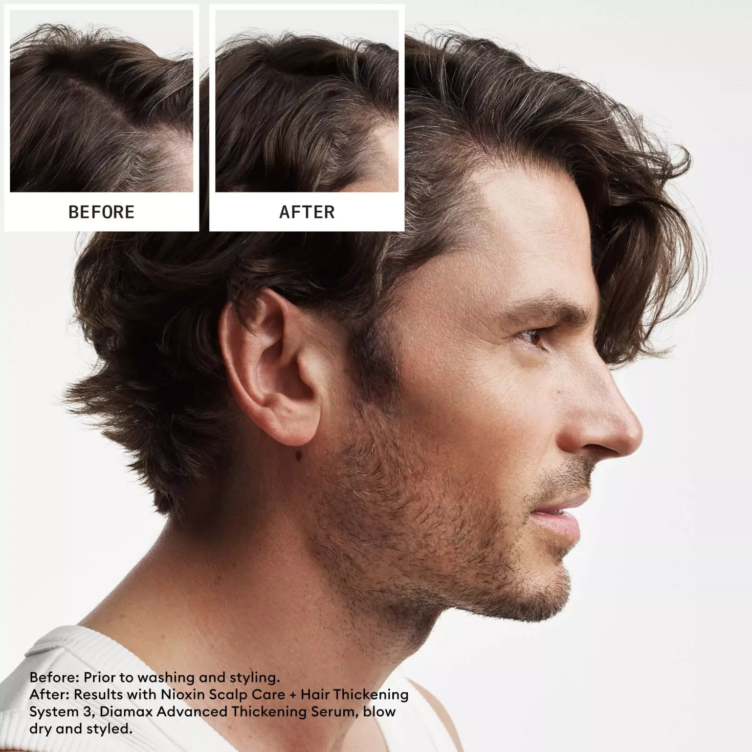 NioxinSystem 2 Loyalty Kit for Thinning Hair
