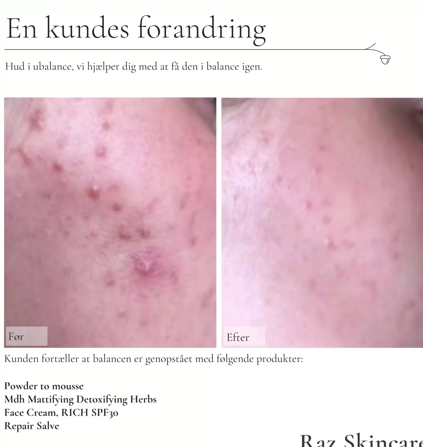 Raz Skincare Powder to Mousse Cleanser 50 g
