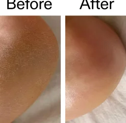 The Inkey List Glycolic Acid Exfoliating Body Stick 45 g