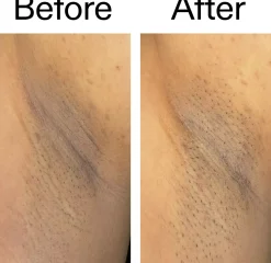 The Inkey List Glycolic Acid Exfoliating Body Stick 45 g