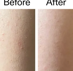 The Inkey List Glycolic Acid Exfoliating Body Stick 45 g