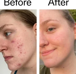 The Inkey List Glycolic Acid Toner 100 ml