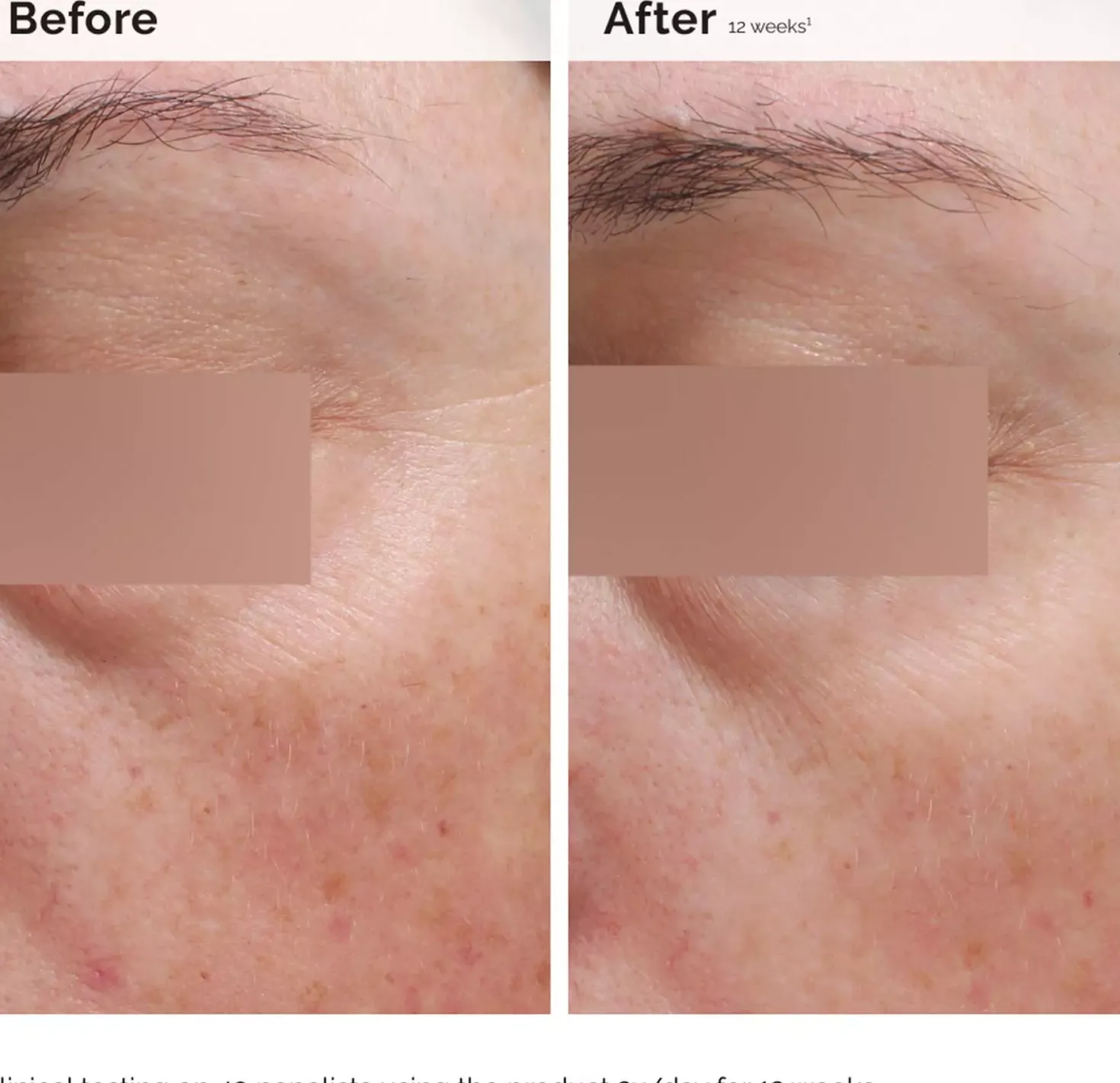 The Ordinary Niacinamide 5% Face & Body Emulsion 100 ml