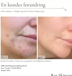 The Ordinary Squalane Cleanser 150 ml